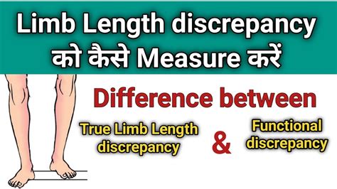 legs measure thickness distances|how to measure leg length discrepancy.